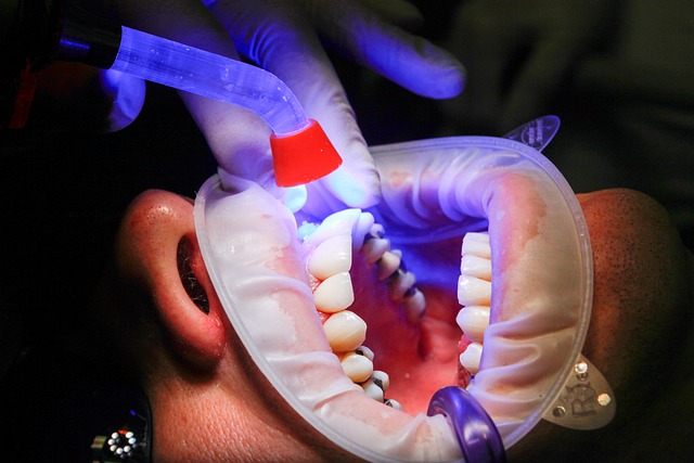 dentist prices expect